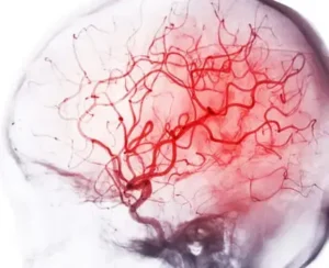 Multi-Scale Brain Imaging