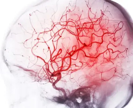 Multi-Scale Brain Imaging