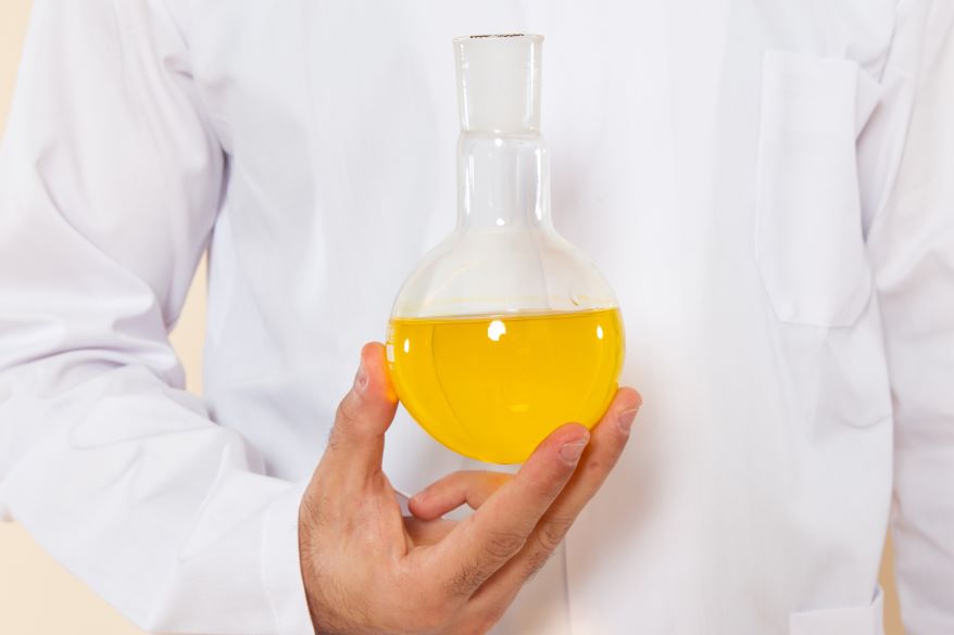 Ketogenesis