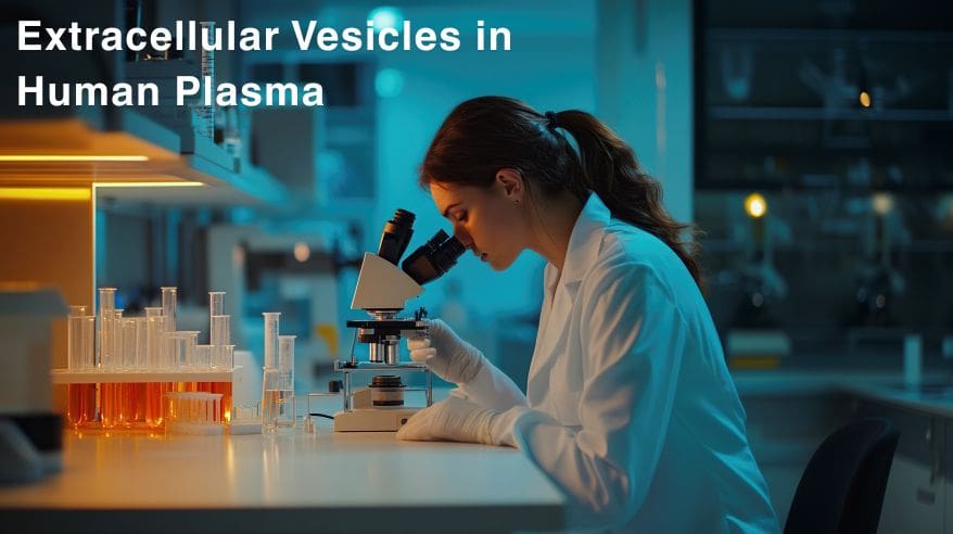 Extracellular Vesicles in Human Plasma