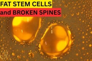 fat stem cells